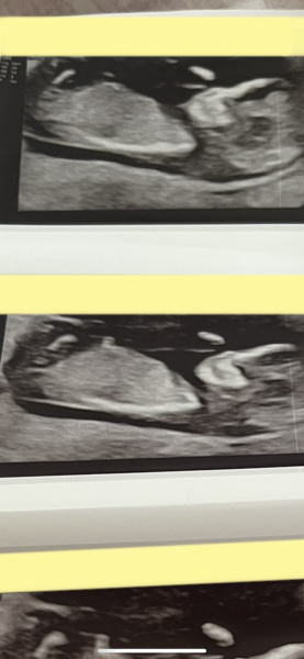 Girl/boy guesses!