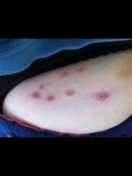 What could this rash be?