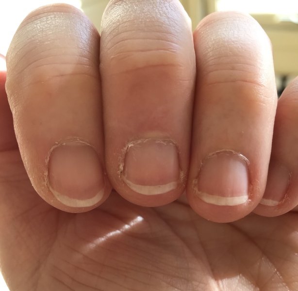 Help! (nails)