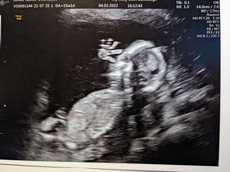July 2023 (Thread 2)! 