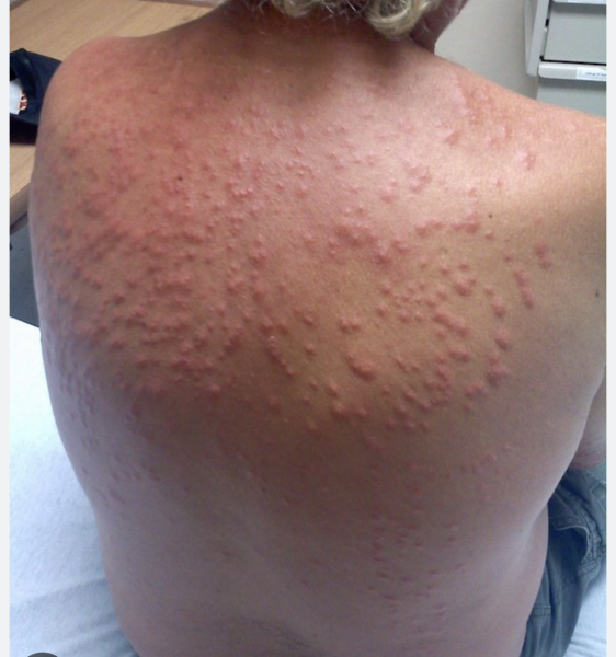 Fleas or bed bugs? Please help! Pic attached.