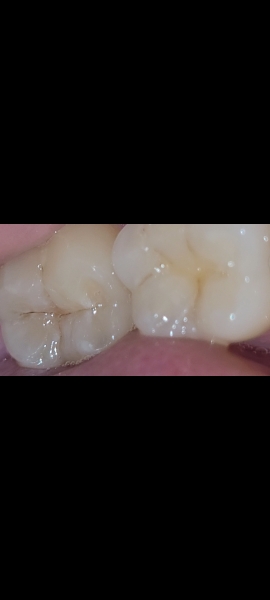 Any dentists on here....(pics)