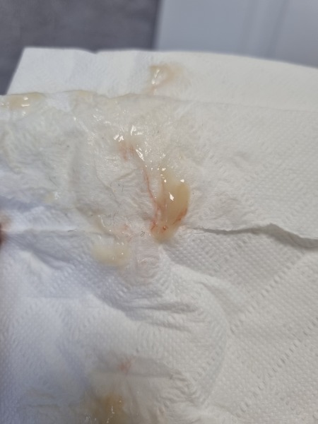 Due March 2023 - Thread 8