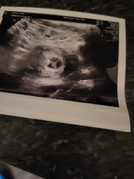 Due October 2023 -Thread 2