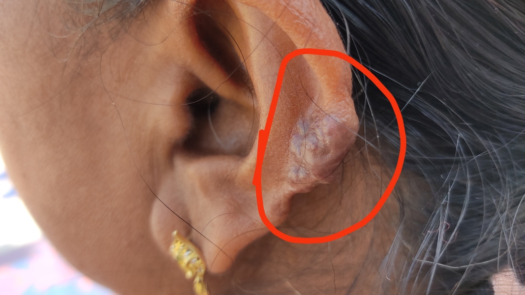 Ear Issue