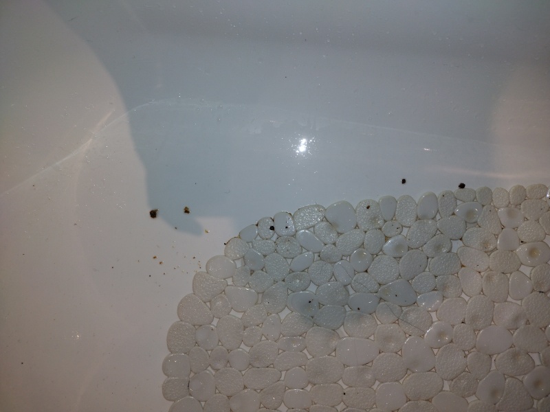 Ears successfully cleared of huge blockage!