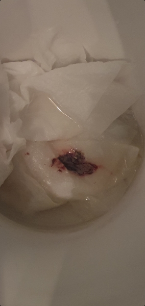 Sorry.....graphic photo.....I think its all over.
