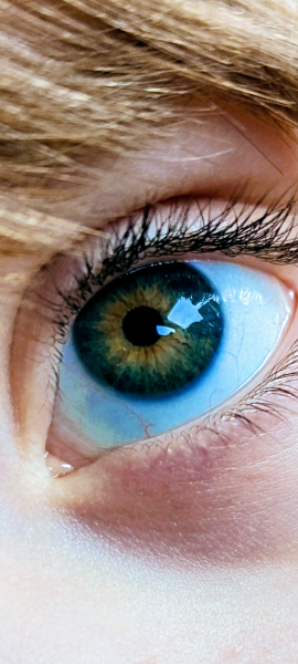 Eye Colour disagreement 