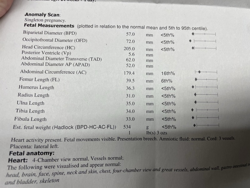 Small head circumference 20 weeks