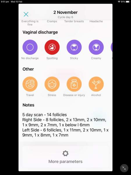 What IVF dose and how many eggs did you get?