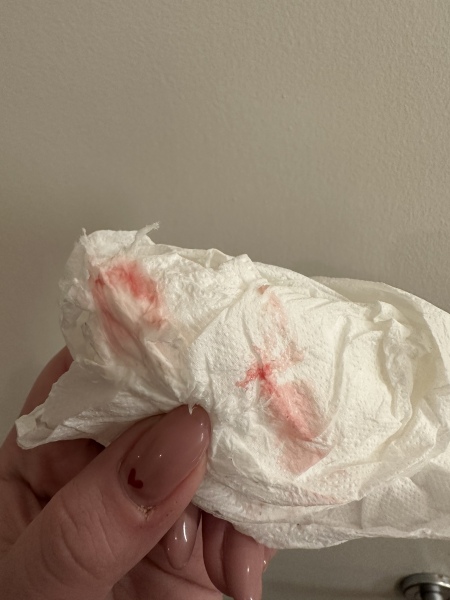 Bleeding after BFP - photo. 