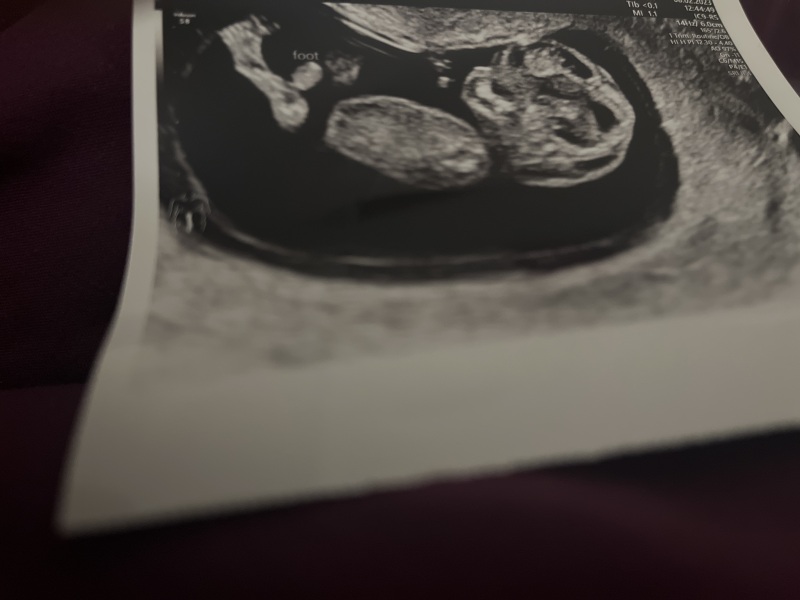 Trying to Conceive over 40 part 3