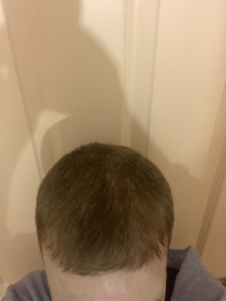 Cancer Support Thread 85 - Hoping for a positive 2023