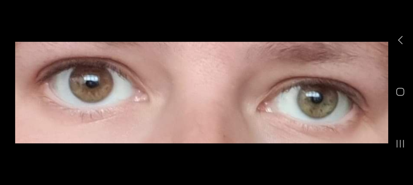 I'm 40 and I don't know what colour my eyes are! Photos