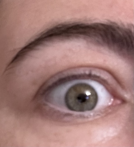 I'm 40 and I don't know what colour my eyes are! Photos