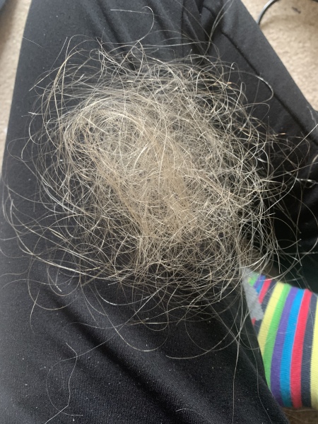 Is this peri menopause?