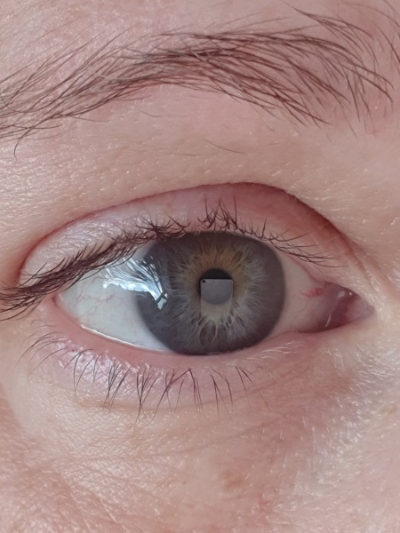 I'm 40 and I don't know what colour my eyes are! Photos