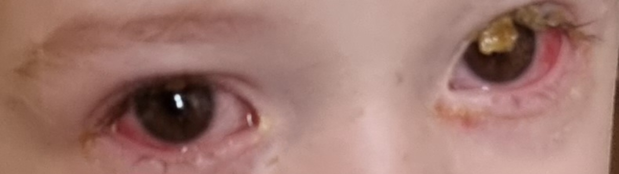 In need of Chloramphenicol -pics attached