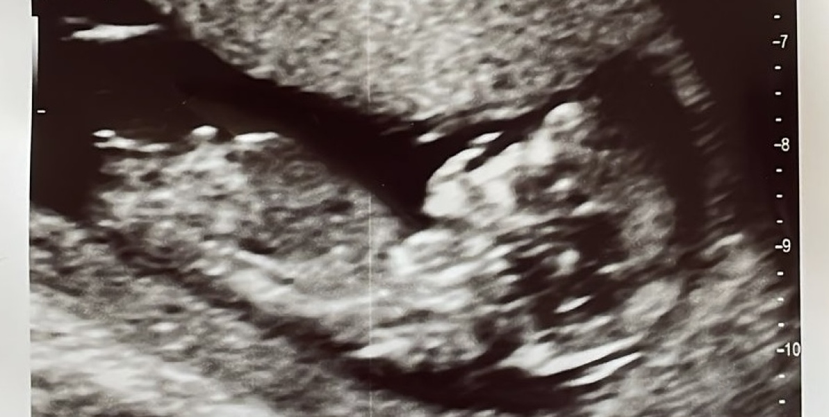 Boy or girl?