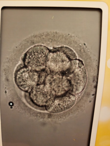 Success with 9 cell embryos at day 3