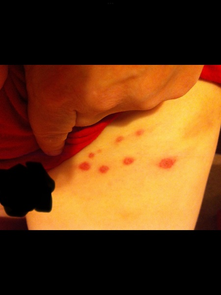 What could this rash be?