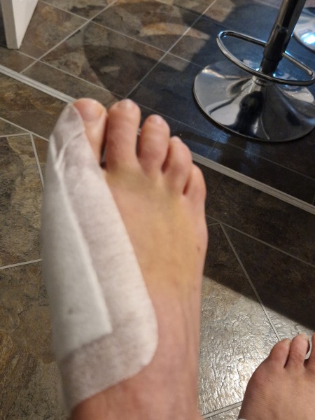 Show me a pic of your bunions…