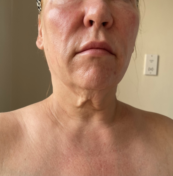 My turkey neck