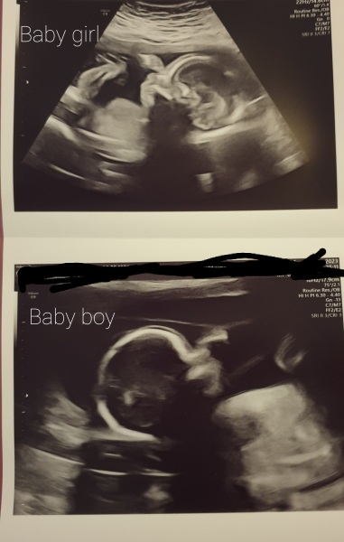 June 2023 Babies ☀️ (thread four)