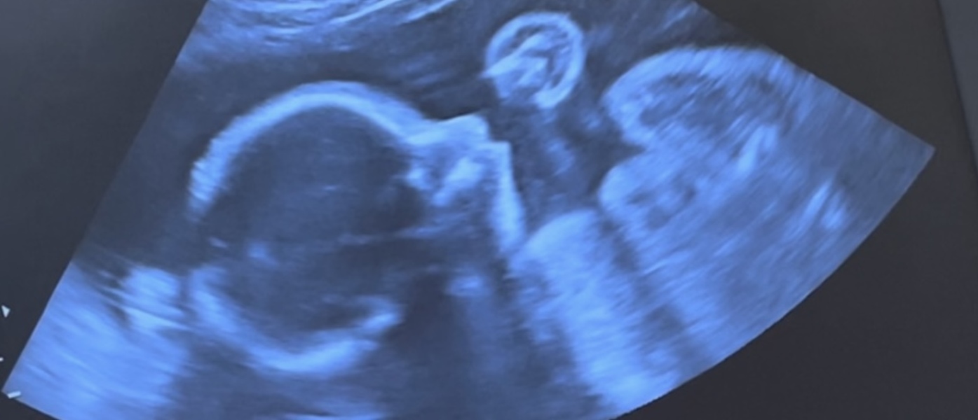 Baby Gender Guesses??