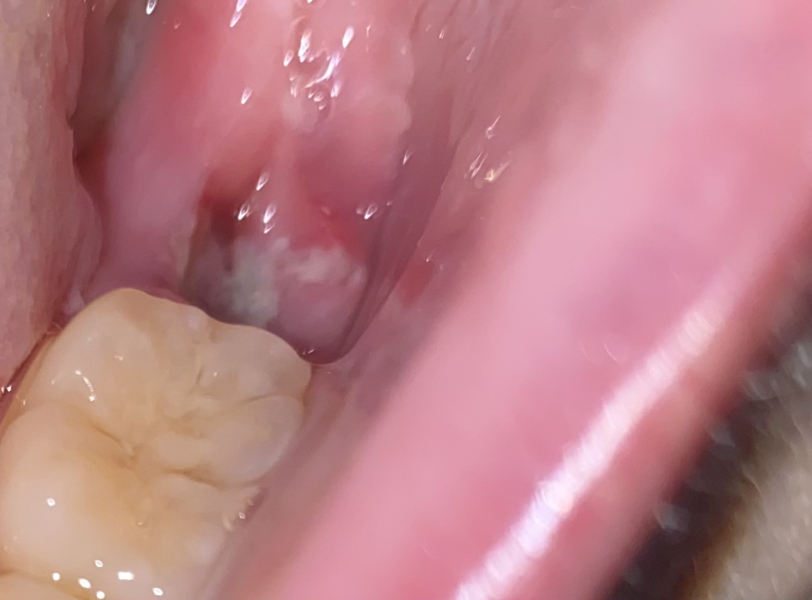 Does this look normal?