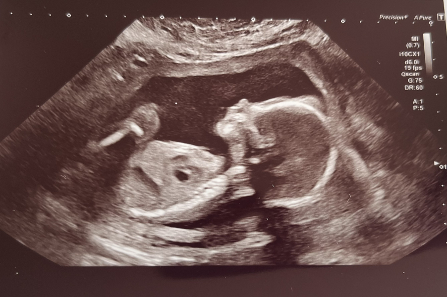 June 2023 Babies ☀️ (thread four)