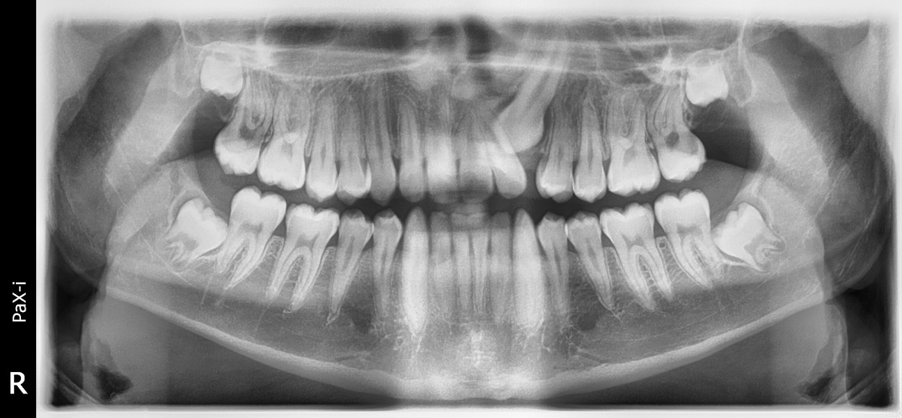 Any orthodontists around?