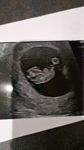 5 weeks today! Sep 23 Thread