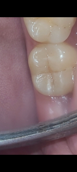 Any dentists on here....(pics)