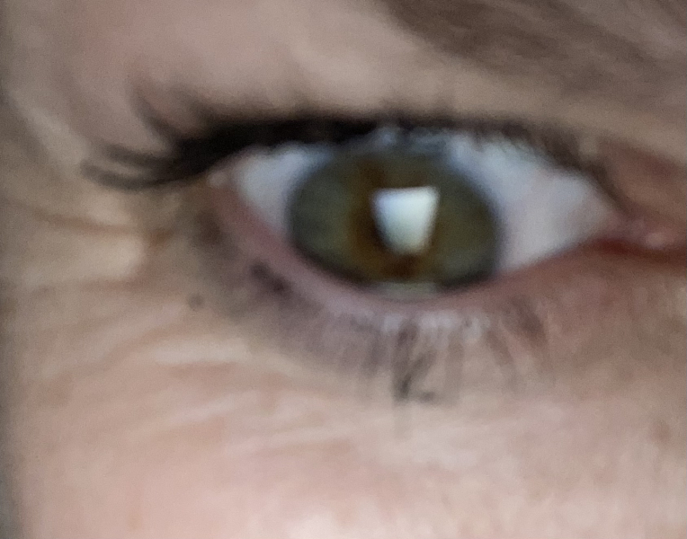I'm 40 and I don't know what colour my eyes are! Photos