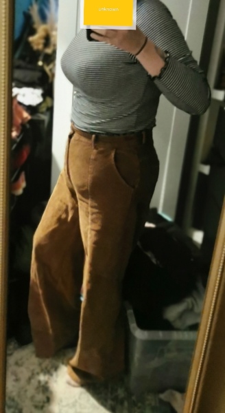 Can anyone recommend shape wear for this issue? (pic) 