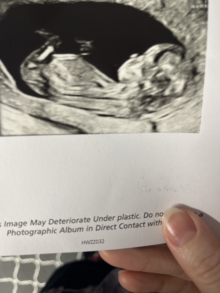 Girl or boy ?