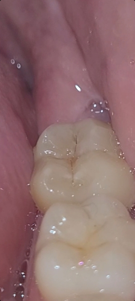 Any dentists on here....(pics)