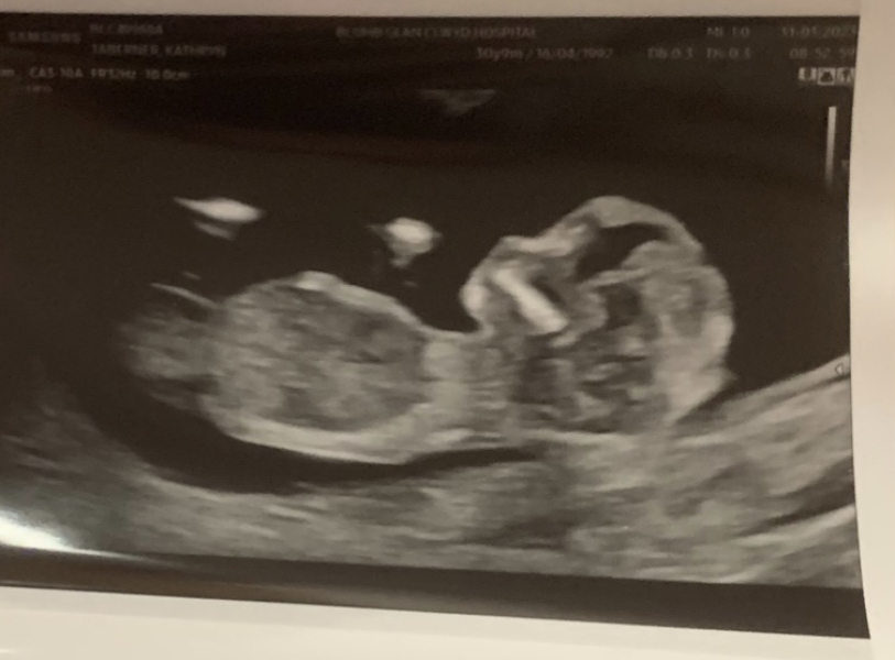 August Due Date Crew - Into Trimester 2 (Thread 6)