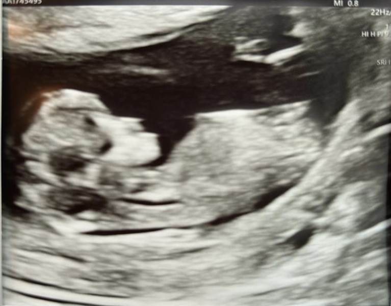 Any gender guesses please? 