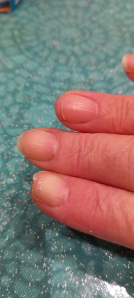 Can anyone recommend a proven nail supplement for very thin brittle nails please?