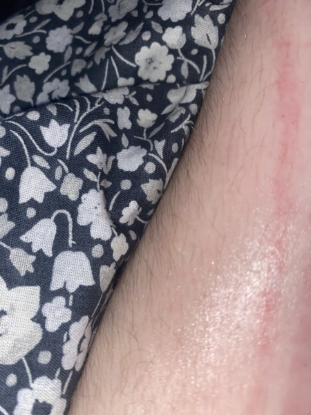 Help! Will this scar?