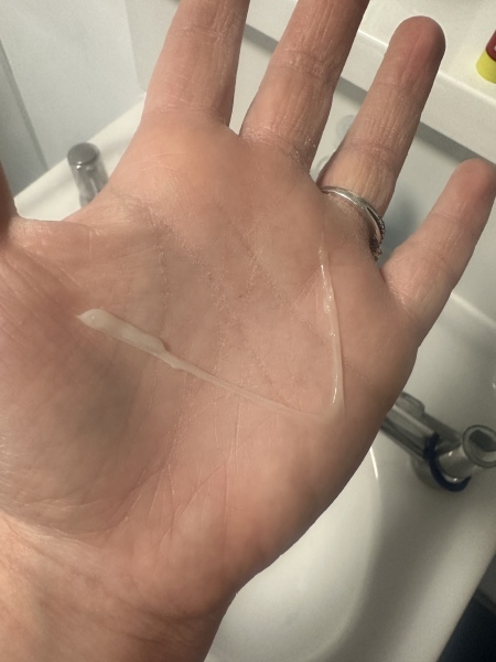 Is this mucus plug or normal discharge?