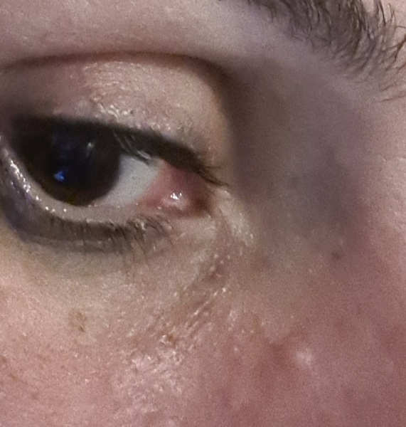 Please look at picture and tell me if it is a wart