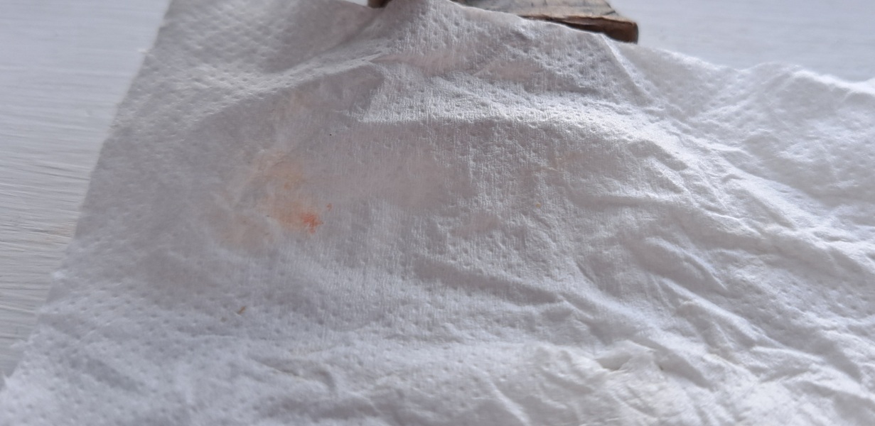 Is this period or implantation spotting?