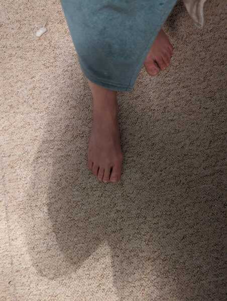 Show me a pic of your bunions…