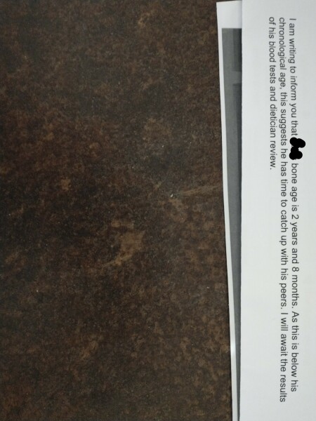 Confused by bone age result can anyone help?