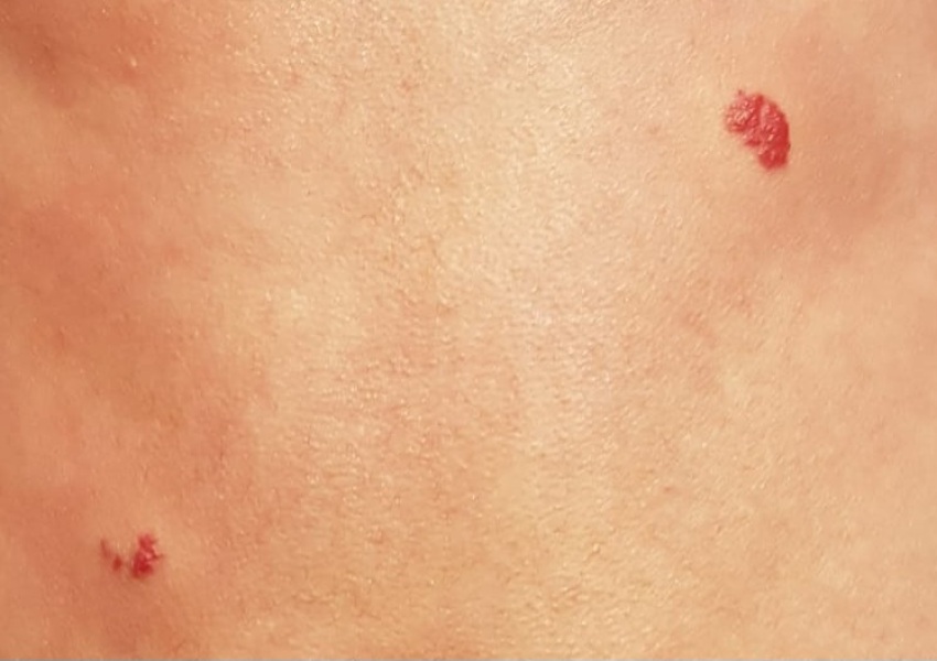 Marks on 5 week old?