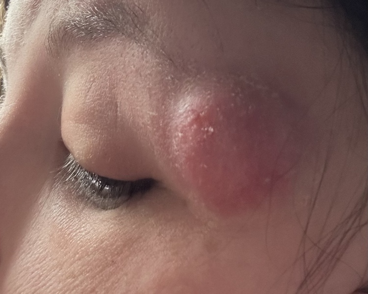 Doctors ignoring me for a year and now it's come to this