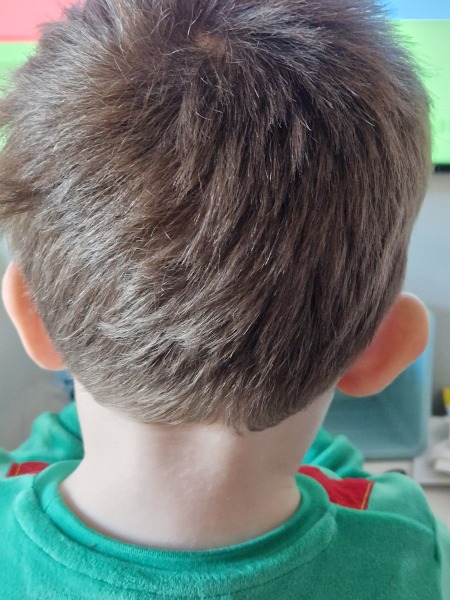 Is this mastoiditis?
